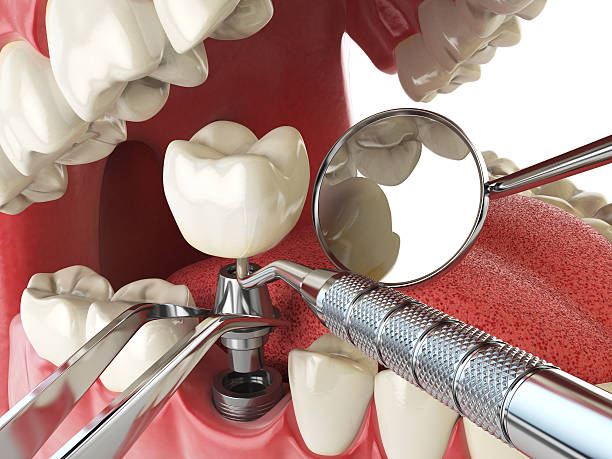 Best Emergency Broken Tooth Repair in Conrad, MT